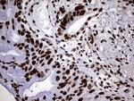 HNRNPM Antibody in Immunohistochemistry (Paraffin) (IHC (P))