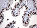 HNRNPM Antibody in Immunohistochemistry (Paraffin) (IHC (P))