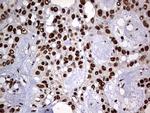 HNRNPM Antibody in Immunohistochemistry (Paraffin) (IHC (P))