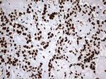 HNRNPM Antibody in Immunohistochemistry (Paraffin) (IHC (P))