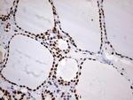 HNRNPM Antibody in Immunohistochemistry (Paraffin) (IHC (P))