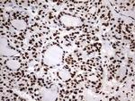 HNRNPM Antibody in Immunohistochemistry (Paraffin) (IHC (P))