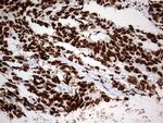 HNRNPM Antibody in Immunohistochemistry (Paraffin) (IHC (P))