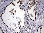 HNRNPM Antibody in Immunohistochemistry (Paraffin) (IHC (P))