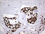 HNRNPM Antibody in Immunohistochemistry (Paraffin) (IHC (P))