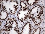 HNRNPM Antibody in Immunohistochemistry (Paraffin) (IHC (P))