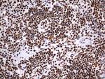 HNRNPM Antibody in Immunohistochemistry (Paraffin) (IHC (P))