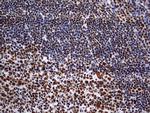 HNRNPM Antibody in Immunohistochemistry (Paraffin) (IHC (P))