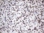 HNRNPM Antibody in Immunohistochemistry (Paraffin) (IHC (P))