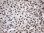 HNRNPM Antibody in Immunohistochemistry (Paraffin) (IHC (P))