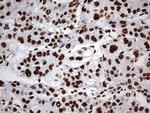 HNRNPM Antibody in Immunohistochemistry (Paraffin) (IHC (P))