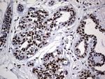 HNRNPM Antibody in Immunohistochemistry (Paraffin) (IHC (P))