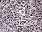 HNRNPM Antibody in Immunohistochemistry (Paraffin) (IHC (P))