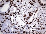 HNRNPM Antibody in Immunohistochemistry (Paraffin) (IHC (P))