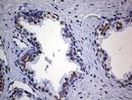 HNRNPM Antibody in Immunohistochemistry (Paraffin) (IHC (P))