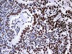 HNRNPM Antibody in Immunohistochemistry (Paraffin) (IHC (P))