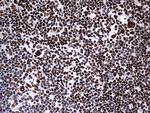 HNRNPM Antibody in Immunohistochemistry (Paraffin) (IHC (P))