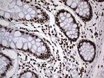 HNRNPM Antibody in Immunohistochemistry (Paraffin) (IHC (P))