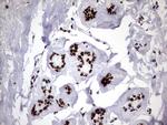 HNRNPM Antibody in Immunohistochemistry (Paraffin) (IHC (P))