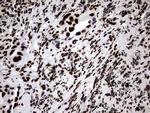 HNRNPM Antibody in Immunohistochemistry (Paraffin) (IHC (P))