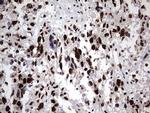 HNRNPM Antibody in Immunohistochemistry (Paraffin) (IHC (P))