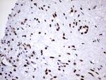 HNRNPM Antibody in Immunohistochemistry (Paraffin) (IHC (P))