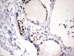 HNRNPM Antibody in Immunohistochemistry (Paraffin) (IHC (P))