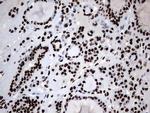 HNRNPM Antibody in Immunohistochemistry (Paraffin) (IHC (P))