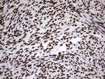 HNRNPM Antibody in Immunohistochemistry (Paraffin) (IHC (P))