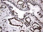 HNRNPM Antibody in Immunohistochemistry (Paraffin) (IHC (P))