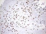 HNRNPM Antibody in Immunohistochemistry (Paraffin) (IHC (P))