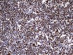 HNRNPM Antibody in Immunohistochemistry (Paraffin) (IHC (P))