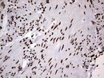 HNRNPM Antibody in Immunohistochemistry (Paraffin) (IHC (P))