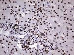 HNRNPM Antibody in Immunohistochemistry (Paraffin) (IHC (P))