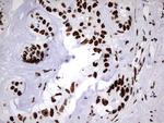 HNRNPM Antibody in Immunohistochemistry (Paraffin) (IHC (P))