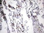 HNRNPM Antibody in Immunohistochemistry (Paraffin) (IHC (P))