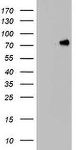 HNRNPM Antibody in Western Blot (WB)