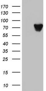 HNRNPM Antibody in Western Blot (WB)