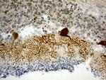 HOMER1 Antibody in Immunohistochemistry (Paraffin) (IHC (P))