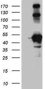 HOMER1 Antibody in Western Blot (WB)