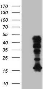 HOXC10 Antibody in Western Blot (WB)
