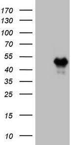 HOXC10 Antibody in Western Blot (WB)