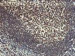 HOXC11 Antibody in Immunohistochemistry (Paraffin) (IHC (P))