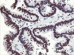 HOXC11 Antibody in Immunohistochemistry (Paraffin) (IHC (P))