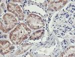 HOXC11 Antibody in Immunohistochemistry (Paraffin) (IHC (P))