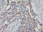 HOXC11 Antibody in Immunohistochemistry (Paraffin) (IHC (P))