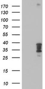 HOXC11 Antibody in Western Blot (WB)