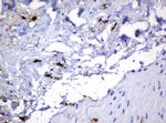 HOXD10 Antibody in Immunohistochemistry (Paraffin) (IHC (P))