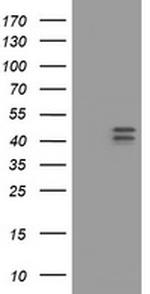 HOXD10 Antibody in Western Blot (WB)