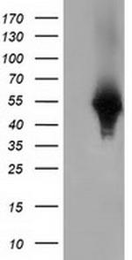 HP Antibody in Western Blot (WB)